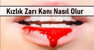 Kızlık zarı lekesi