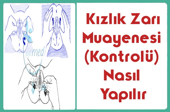 Kızlık Zarı Muayenesi Kontrolü Nasıl Yapılır