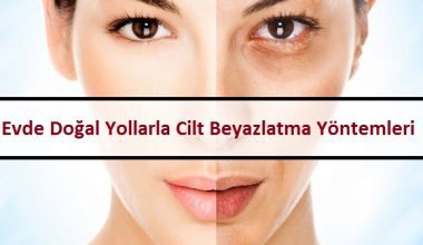 Evde Doğal Yollarla Cilt Beyazlatma Yöntemleri Evde Doğal Yollarla Cilt Beyazlatma Yöntemleri