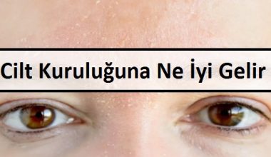 Cilt Kuruluğuna Ne İyi Gelir Cilt Kuruluğuna Ne İyi Gelir