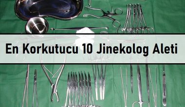 En Korkutucu 10 Jinekolog Muayene Aleti En Korkutucu 10 Jinekolog Muayene Aleti