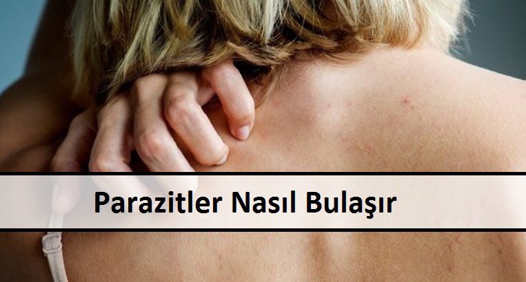 Parazitler Nasıl Bulaşır