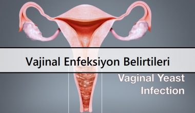 Vajinal Enfeksiyon Belirtileri Vajinal Enfeksiyon Belirtileri