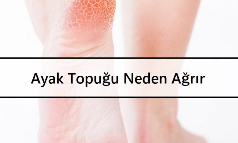 Ayak Topuğu Neden Ağrır