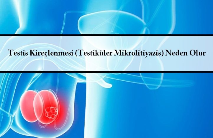 Testis Kireçlenmesi (Testiküler Mikrolitiyazis) Neden Olur