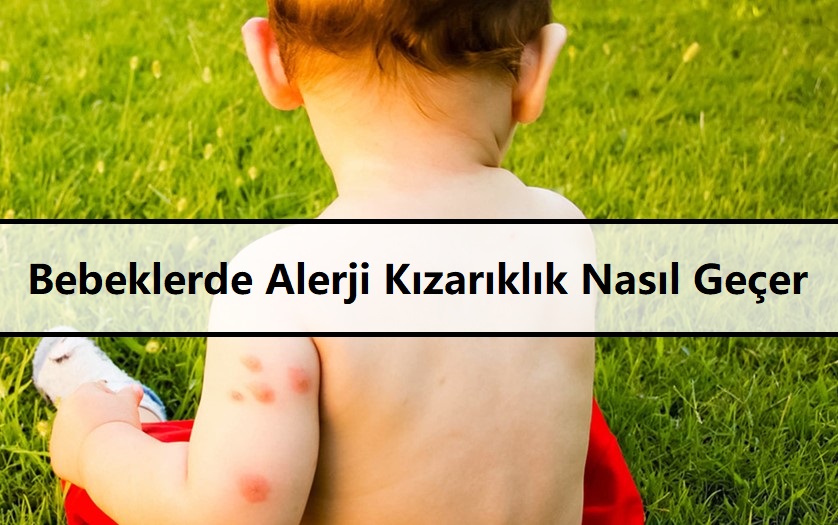 Bebeklerde Alerji Kızarıklık Nasıl Geçer