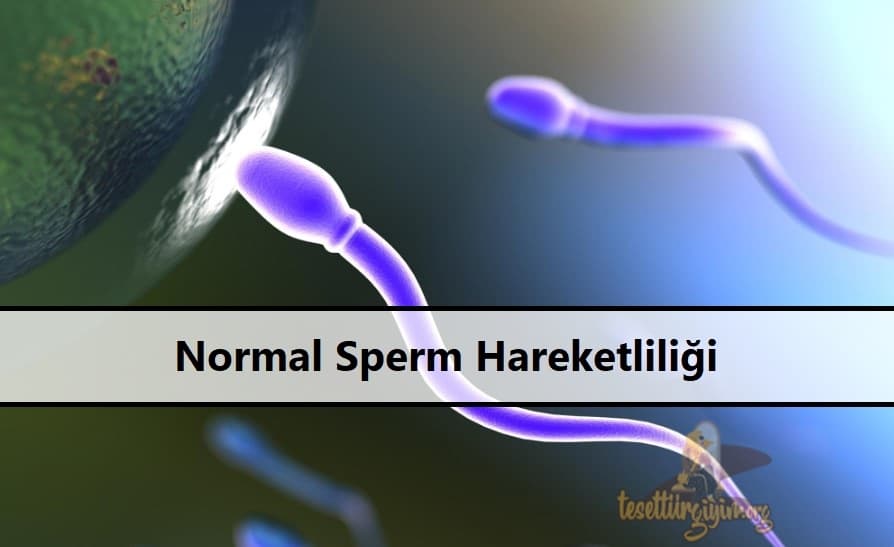 Normal Sperm Hareketliliği